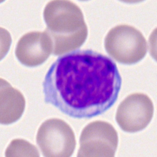 lymphocyte